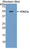 Androgen Receptor antibody, LS-C292800, Lifespan Biosciences, Western Blot image 