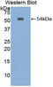 Mesothelin antibody, LS-C297752, Lifespan Biosciences, Western Blot image 