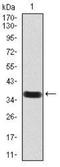 Glutamate Decarboxylase 2 antibody, NBP2-52470, Novus Biologicals, Western Blot image 