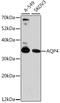 Aquaporin 4 antibody, LS-C748941, Lifespan Biosciences, Western Blot image 