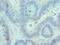Chromobox 8 antibody, LS-C379397, Lifespan Biosciences, Immunohistochemistry paraffin image 