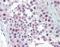 Protein Arginine Methyltransferase 5 antibody, orb88199, Biorbyt, Immunohistochemistry paraffin image 
