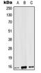 Interleukin 9 antibody, LS-C353736, Lifespan Biosciences, Western Blot image 