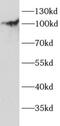 Itchy E3 Ubiquitin Protein Ligase antibody, FNab10329, FineTest, Western Blot image 