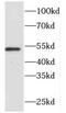 Flavin Containing Dimethylaniline Monoxygenase 2 antibody, FNab03168, FineTest, Western Blot image 