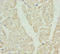 Hydroxyacyl-CoA Dehydrogenase antibody, orb40880, Biorbyt, Immunohistochemistry paraffin image 