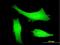 E3 ubiquitin-protein ligase Itchy homolog antibody, H00083737-M06, Novus Biologicals, Immunocytochemistry image 