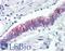 NAD(P)H Quinone Dehydrogenase 1 antibody, LS-B116, Lifespan Biosciences, Immunohistochemistry paraffin image 