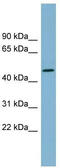 Tryptophan 2,3-Dioxygenase antibody, TA338147, Origene, Western Blot image 