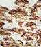 Insulin Like Growth Factor Binding Protein 4 antibody, LS-C165149, Lifespan Biosciences, Immunohistochemistry frozen image 