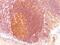 MALT1 Paracaspase antibody, MBS438138, MyBioSource, Immunohistochemistry paraffin image 