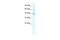 Potassium Channel Tetramerization Domain Containing 10 antibody, A10353, Boster Biological Technology, Western Blot image 