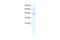 Potassium Channel Tetramerization Domain Containing 10 antibody, A10353, Boster Biological Technology, Western Blot image 