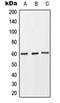Fc Fragment Of IgA Receptor antibody, orb215468, Biorbyt, Western Blot image 