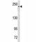 Notch Receptor 3 antibody, F40367-0.4ML, NSJ Bioreagents, Western Blot image 