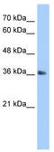 TIMELESS-interacting protein antibody, TA339727, Origene, Western Blot image 