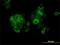 Myocyte Enhancer Factor 2A antibody, H00004205-M15, Novus Biologicals, Immunocytochemistry image 