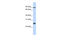 RNA Binding Protein, MRNA Processing Factor antibody, 25-596, ProSci, Enzyme Linked Immunosorbent Assay image 