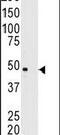 Melanoma-associated antigen 11 antibody, PA5-13148, Invitrogen Antibodies, Western Blot image 