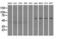 Fumarate Hydratase antibody, M02097-1, Boster Biological Technology, Western Blot image 