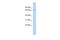 Zinc Finger Protein 404 antibody, A17625, Boster Biological Technology, Western Blot image 