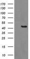 Gamma-Butyrobetaine Hydroxylase 1 antibody, TA505786, Origene, Western Blot image 