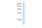 DExH-Box Helicase 9 antibody, PA5-41259, Invitrogen Antibodies, Western Blot image 