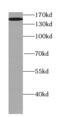 Testis Expressed 15, Meiosis And Synapsis Associated antibody, FNab08610, FineTest, Western Blot image 