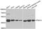 Protein Phosphatase, Mg2+/Mn2+ Dependent 1A antibody, A6699, ABclonal Technology, Western Blot image 