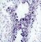 Phosphatase And Tensin Homolog antibody, 79-296, ProSci, Immunohistochemistry frozen image 