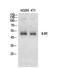 Interleukin 6 Receptor antibody, STJ97241, St John