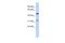 HtrA Serine Peptidase 4 antibody, A13079, Boster Biological Technology, Western Blot image 