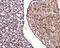 Transient Receptor Potential Cation Channel Subfamily M Member 7 antibody, GTX54865, GeneTex, Immunohistochemistry paraffin image 