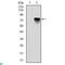 BMI1 Proto-Oncogene, Polycomb Ring Finger antibody, LS-C812513, Lifespan Biosciences, Western Blot image 