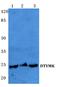 Deoxythymidylate Kinase antibody, A12209-1, Boster Biological Technology, Western Blot image 