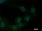 Zinc Finger E-Box Binding Homeobox 1 antibody, H00006935-M01, Novus Biologicals, Immunocytochemistry image 