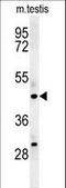 STAM Binding Protein Like 1 antibody, LS-C161540, Lifespan Biosciences, Western Blot image 