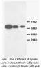 Matrix metalloproteinase-16 antibody, LS-C171911, Lifespan Biosciences, Western Blot image 