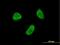 Zinc Finger Protein 7 antibody, H00007553-M04, Novus Biologicals, Immunocytochemistry image 