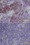 CD276 Molecule antibody, AF1027, R&D Systems, Immunohistochemistry paraffin image 