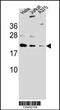 ADP Ribosylation Factor Like GTPase 6 Interacting Protein 6 antibody, 56-998, ProSci, Western Blot image 