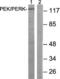 Eukaryotic Translation Initiation Factor 2 Alpha Kinase 3 antibody, abx012935, Abbexa, Western Blot image 