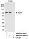 Tyrosyl-DNA Phosphodiesterase 1 antibody, NB100-81643, Novus Biologicals, Immunoprecipitation image 