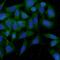 TPS1 antibody, FNab08903, FineTest, Immunofluorescence image 