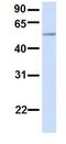 Phosphatidylinositol Glycan Anchor Biosynthesis Class T antibody, GTX46349, GeneTex, Western Blot image 