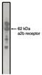 Adrenoceptor Alpha 2B antibody, AM05339PU-N, Origene, Western Blot image 