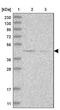 Dystrobrevin Binding Protein 1 antibody, NBP1-85299, Novus Biologicals, Western Blot image 