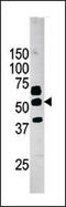 Pantothenate Kinase 2 antibody, AP13804PU-N, Origene, Western Blot image 