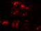 SID1 Transmembrane Family Member 1 antibody, orb125203, Biorbyt, Immunocytochemistry image 