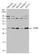 STIP1 Homology And U-Box Containing Protein 1 antibody, PA5-32046, Invitrogen Antibodies, Western Blot image 